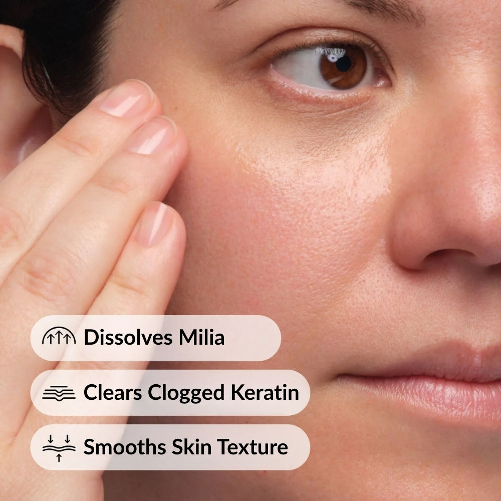 Milia Removal Serum